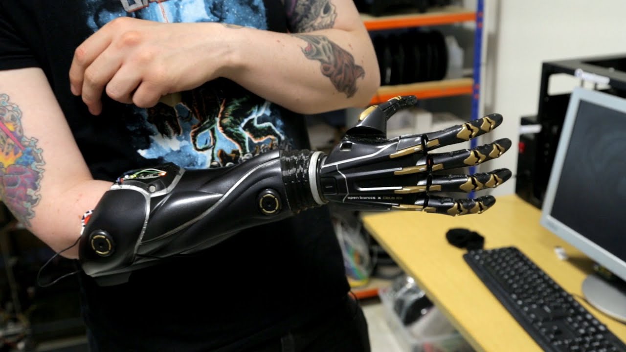 Tilly Lockey and the Revolutionary Bionic Innovation